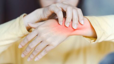 Acı içinde bileğini tutan kişinin yakın çekimi, rahatsızlığı ve iltihabı vurguluyor. Eklem iltihabı veya bilek yaralanması kavramı.