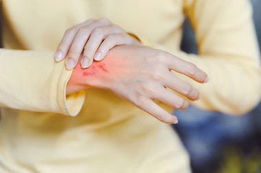 Bileğini acı içinde tutan kişinin yakın çekimi, gözle görülür kırmızı iltihaplanma alanı, eklem ya da kas rahatsızlığını gösterir.