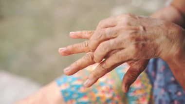 Yaşlıların el ve parmaklarını kaşıyan, cilt tahrişini, kaşıntıyı, alerjiyi veya kuruluğu temsil eden, tıbbi, dermatoloji ve sağlıkla ilgili içeriklere uygun, yakın çekim görüntüleri..