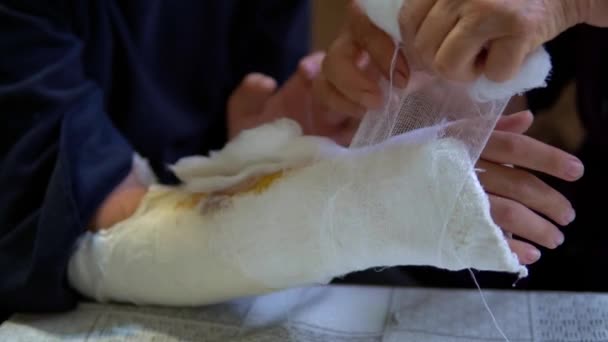 Bandage Såret Hemma Tillämpar Medicin Högkvalitativ Film — Stockvideo