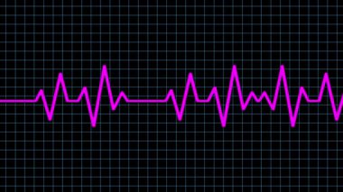a pink heartbeat line on a black grid with blue lines shows a steady heart rhythm on a monitor display