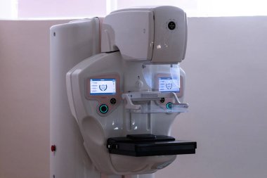 Çift etkileşimli ekranları olan modern bir mammografi makinesi, temiz bir tıbbi odada, tanı taraması için hazır bekliyor.