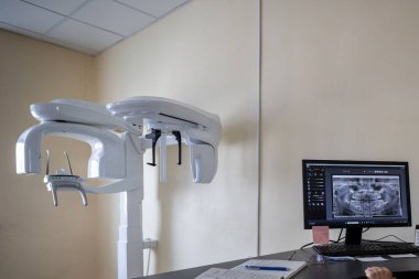 Modern bir X-Mind Prime panoramik diş röntgeni makinesi, bir ortomograf, klinik ortamında monitöründe dijital bir diş görüntüsü gösterir.