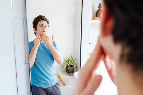 Concentrated Caucasian Teenage Boy Acne Problem His Face Looking Mirror — 스톡 사진