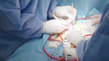 Lens blurred view, heart complex surgery process, close up of surgeons hands, professional medical team at work, out of focus.