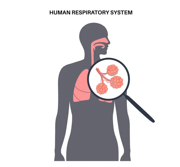 人类呼吸系统解剖海报 男性身体轮廓中的隆起 支气管炎和肺泡 呼吸的过程 诊所或医院病媒图解的教育图 — 图库矢量图片
