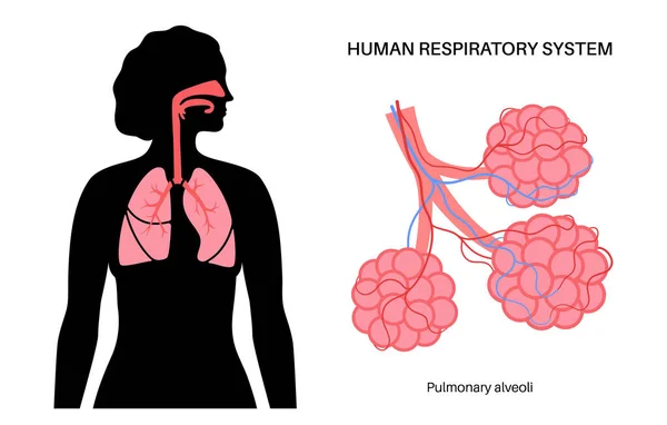 ヒト呼吸器系解剖ポスター 女性の体のシルエットで気管支や肺の肺胞 呼吸のプロセス 教育図 診療所のバナー 病院のベクトル図 — ストックベクタ