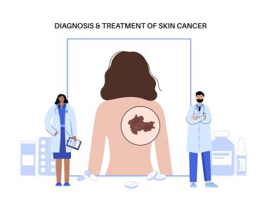 Bir kadının sırtında Melanoma, cilt kanseri gelişimi. Kötü huylu tümör teşhisi ve tedavisi. Pigment melanosit hücreleri üretiyor. Laboratuvar düz vektör illüstrasyonunda dermatoloji incelemesi