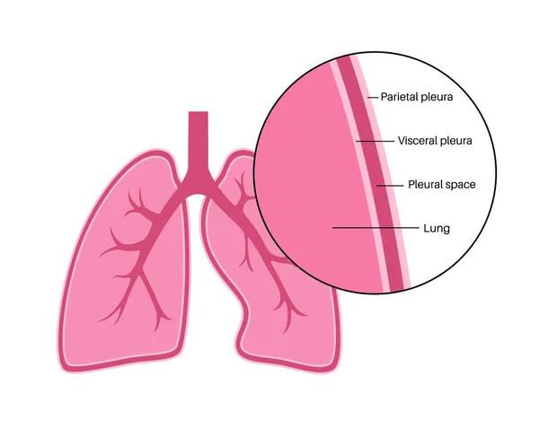 Pleura Anatomy Concept Chest Cavity Medical Poster Membrane Tissue Human — Stock Vector