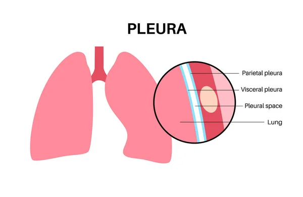プレウラの解剖学的概念 胸部キャビティ医療ポスター 人体の膜組織 呼吸器系の計画 肺プレーリー図 気管支 肋骨のベクトル図 — ストックベクタ