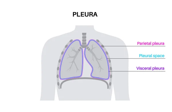 Pleura Anatomi Koncept Läkaraffisch För Brösthålan Membranvävnad Människokroppen System För — Stock vektor