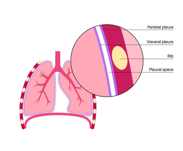 普莱拉解剖学概念 胸腔医疗海报 人体的膜状组织 吸入系统方案 肺叶胸膜图 支气管和肋骨平面矢量图解 — 图库矢量图片