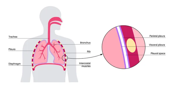 Pleura Anatomian Käsite Rintaontelon Lääkejuliste Kalvokudos Ihmiskehossa Hengitysjärjestelmä Keuhkopussin Kaavio — vektorikuva