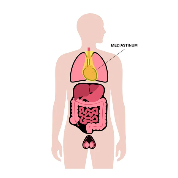 纵隔解剖海报 胸部包含心脏 肺和其他结构的空间 人体中的胸腔 右胸膜腔医学平面矢量图解 — 图库矢量图片