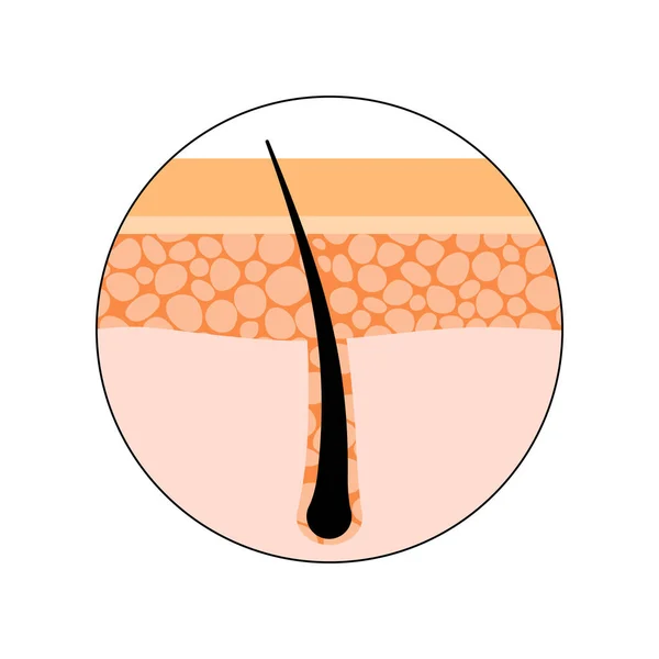 Emberi Haj Anatómiai Poszter Haj Tüsző Ikon Bőr Rétegek Struktúra — Stock Vector