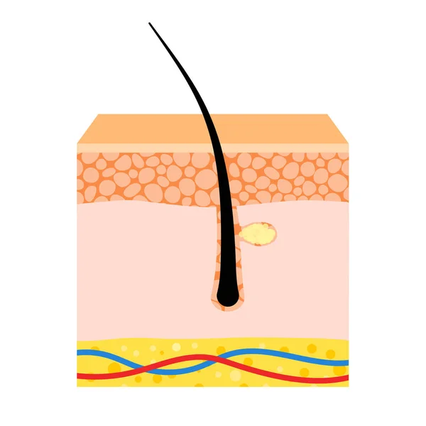 Lidské Vlasy Kožní Anatomický Plakát Ikona Vlasového Folikulu Schéma Struktury — Stockový vektor