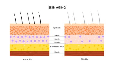 Skin aging concept. Young and old skin comparison, elastane and collagen components. Skin changes with age. Wrinkles on the body over time. Epidermis, dermis and hypodermis flat vector illustration. clipart