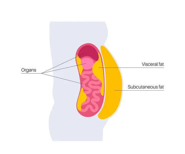 Medische Poster Voor Visceraal Vet Buikvet Omringt Inwendige Organen Buikholte — Stockvector