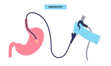 Gastroskopi prosedürü. Gastroenterolog gastroskop kullanıyor. Mide ve onikiparmak bağırsağı taraması. Gastroenteroloji, endoskopi ve mide hastalıkları. Sindirim sistemi enfeksiyonu ve tedavi vektörü