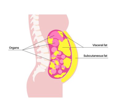İçsel şişman tıbbi afişi. Göbek yağı karın boşluğundaki iç organları sarar. Aşırı kilolu hastalık konsepti. Kilo vermek, yağ aldırmak ve diyet yapmak. Obezite insan silueti düz vektör çizimi