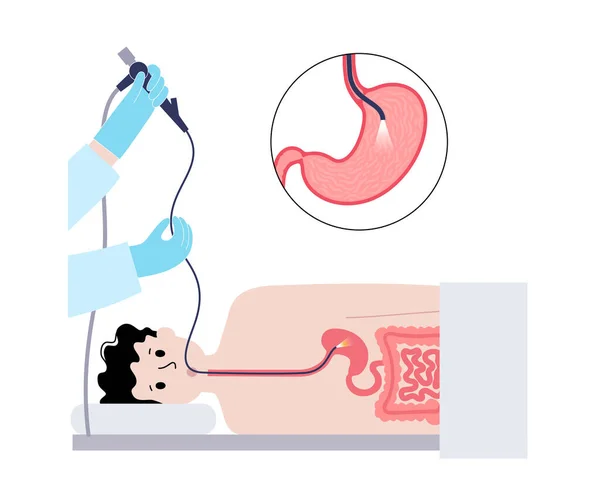 Procedimiento Gastroscopia Gastroenterólogo Usa Gastroscopio Diagnóstico Estómago Intestino Gastroenterología Endoscopia — Archivo Imágenes Vectoriales