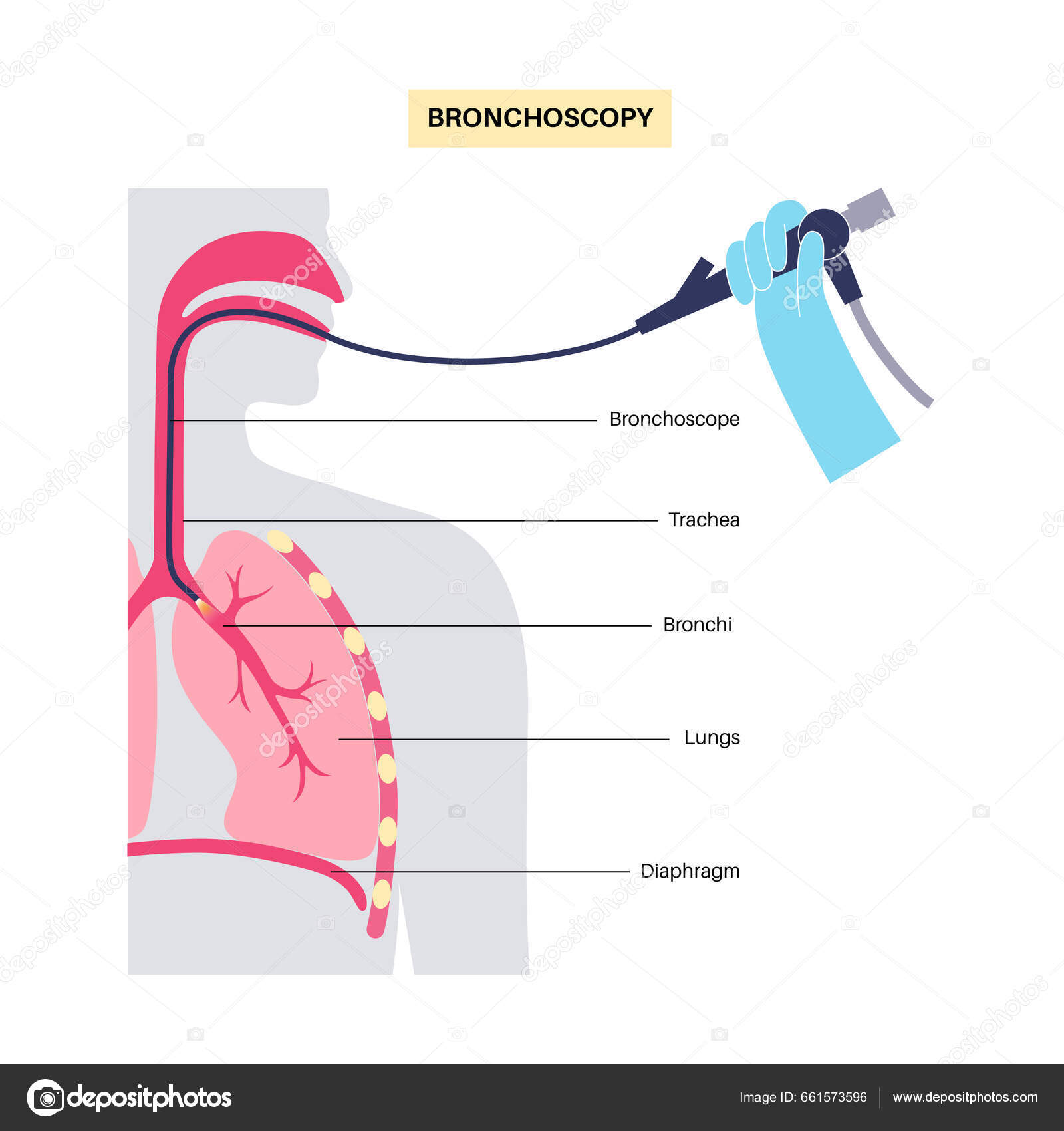 Prosedur Bronchoscopy Pulmonologis Menggunakan Bronkoskop Melalui Mulut Dalam Paru Paru Vektor