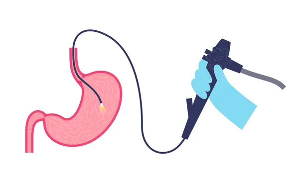 Gastroskopický Zákrok Gastroenterolog Používá Gastroskop Diagnostika Žaludku Dvanáctníku Gastroenterologie Endoskopie — Stockový vektor