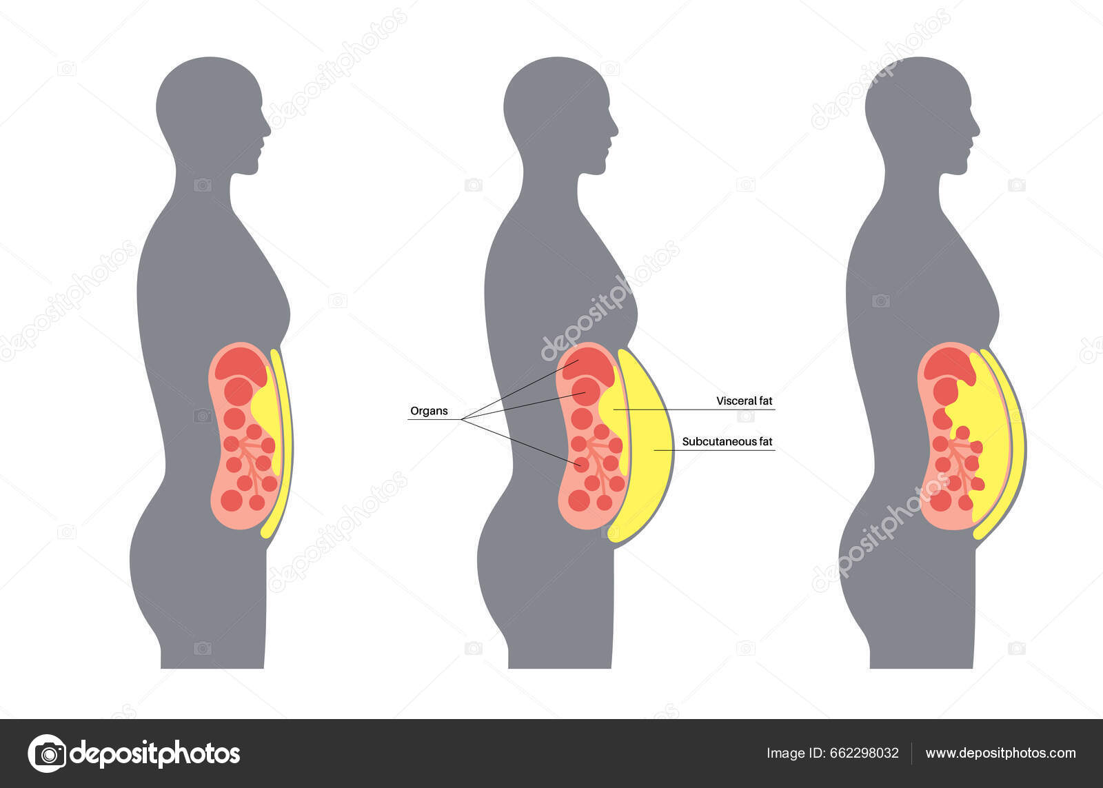 Grasa Visceral Quiero Bajar Grasa Corporal Grasa Visceral Perdida