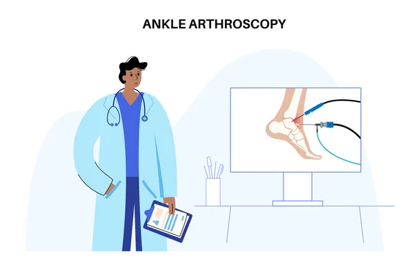 Boka Artroszkópia Eljárás Lábízület Minimálisan Invazív Műtét Konzultáció Orvossal Arthroscope — Stock Vector