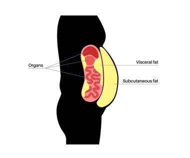 İçsel şişman tıbbi afişi. Göbek yağı karın boşluğundaki iç organları sarar. Aşırı kilolu hastalık konsepti. Kilo vermek, yağ aldırmak ve diyet yapmak. Obezite insan silueti düz vektör çizimi