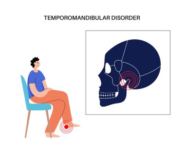 Temporomandibular eklem bozukluğu. TMD ya da TMJ bozukluğu. Çene ekleminde ağrı, şakak kemiği kilitlenmesi ya da yerinden çıkmış disk. Transkütan elektriksel sinir uyarılması. İnsan kafatası ve çene vektörü