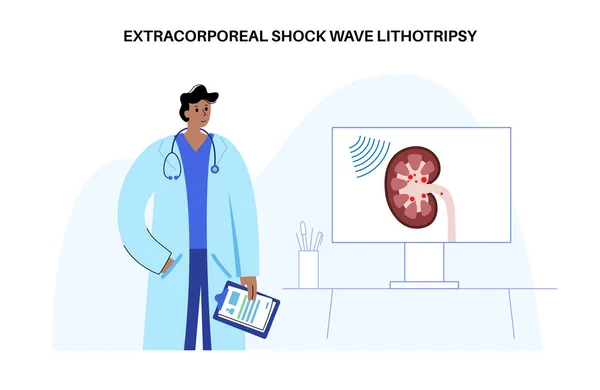 Vesekő Kezelés Extracorporális Lökéshullám Litotripszia Nem Invazív Alternatívája Műtéti Beavatkozásnak — Stock Vector