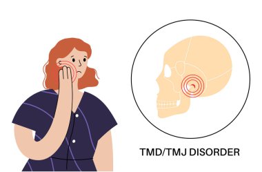 Temporomandibular eklem bozukluğu. TMD ya da TMJ bozukluğu. Çene ekleminde ağrı, şakak kemiği kilitlenmesi ya da yerinden çıkmış disk. Transkütan elektriksel sinir uyarılması. İnsan kafatası ve çene vektörü