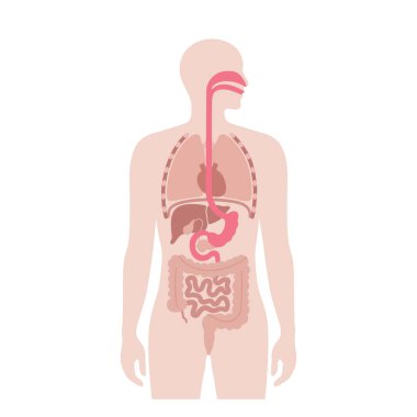 Endoscopic sleeve gastroplasty. Stomach surgery, weight loss gastric procedure. Laparoscopy concept. Overweight problem in human body. Internal organ after operation. Flat vector medical illustration clipart