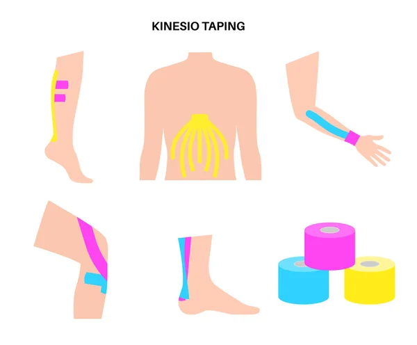 Elastic Therapeutic Tape Kinesiology Tape Arm Leg Shoulder Abdomen Method — Stock Vector