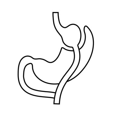 Gastrik baypas gastroplasti ameliyatı. RYGB mide ameliyatı konsepti, obezite sorunu, kilo verme prosedürü. Karın laparoskopisi tıbbi afişi. İnsan vücudu vektör illüstrasyonunda aşırı kilolu problem