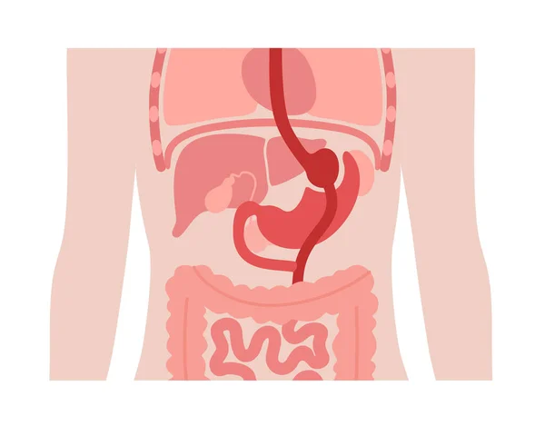 胃旁路胃成形术 Rygb胃外科概念 肥胖问题 体重减轻程序 Abdomen腹腔镜检查医疗海报 人体载体图解中的超重问题 — 图库矢量图片