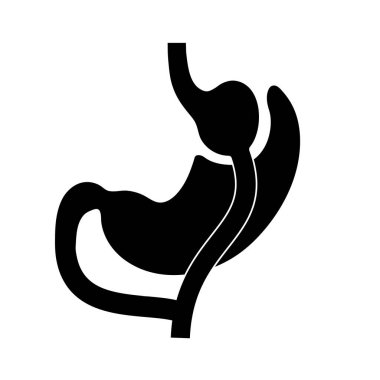 Gastrik baypas gastroplasti ameliyatı. RYGB mide ameliyatı konsepti, obezite sorunu, kilo verme prosedürü. Karın laparoskopisi tıbbi afişi. İnsan vücudu vektör illüstrasyonunda aşırı kilolu problem