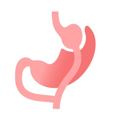 Gastrik baypas gastroplasti ameliyatı. RYGB mide ameliyatı konsepti, obezite sorunu, kilo verme prosedürü. Karın laparoskopisi tıbbi afişi. İnsan vücudu vektör illüstrasyonunda aşırı kilolu problem