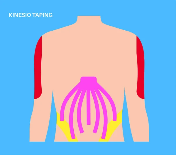 Elastic Therapeutic Tape Kinesiology Tape Shoulder Abdomen Method Elastic Strip — Stock Vector