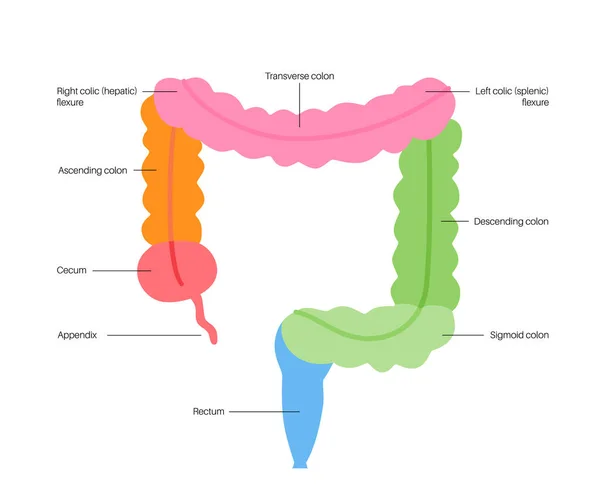 大肠解剖海报 人类肠道的一部分 胃肠科诊所消化道检查和治疗 教育用结肠信息图 孤立的病媒图解 — 图库矢量图片