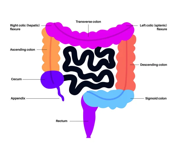 大きな腸内解剖学ポスター 人間の腸の部分 消化管検査と消化器科クリニックでの治療 教育のための植民地のインフォグラフィック 孤立したベクターイラスト — ストックベクタ