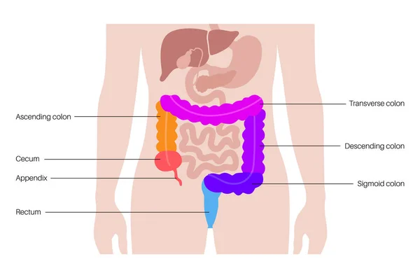Affiche Anatomique Gros Intestin Sections Intestin Humain Examen Traitement Tube — Image vectorielle