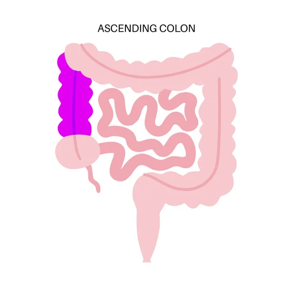 Cartel Colon Ascendente Intestino Grueso Cuerpo Humano Enfermedad Gastrointestinal Diagnóstico — Archivo Imágenes Vectoriales