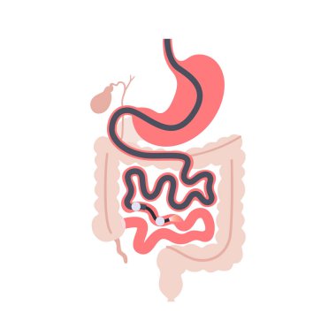 Balon destekli enteroskopi. İnce bağırsak ameliyatsız ameliyatının görselleştirilmesi. Gastrobağırsak yolu muayenesi. Biyopsi, polip çıkarma, kanama terapisi veya stent yerleştirme vektörü çizimi