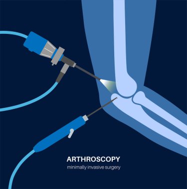 Dirsek eklemi minimal invaziv ameliyat. Artroskopi tıbbi prosedürü. Kol kemiği, dirsek kemiği ve ön kol kemiği anatomisi. Kol ağrısı, kırık, osteoartrit veya romatoid artrit x ışını çizimi