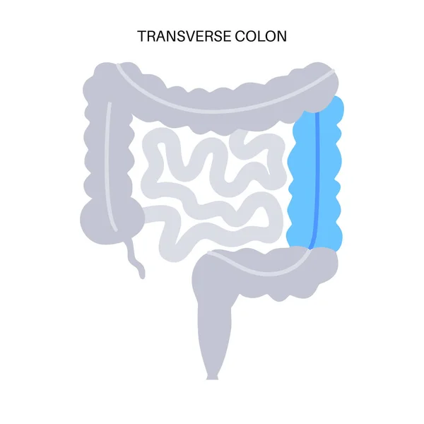 Cartel Transversal Del Colon Intestino Grueso Cuerpo Humano Enfermedad Gastrointestinal — Archivo Imágenes Vectoriales