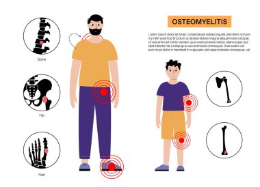 Yetişkinlerde ve çocuklarda kemik iltihabı hastalığı. Omurga, bacak ve kollar enfekte olmuş. Enfeksiyon kan dolaşımından kemiklere yayılır. Staphylococcus aureus bakterisi insan vücudu vektöründe.