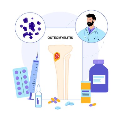 Kemik iltihabı hastalığı. Enfekte olmuş bacak kemikleri, inziva, kızarıklık ve acı. Enfeksiyon kan dolaşımından kaval kemiğine yayılır. Klinik tıbbi vektör illüstrasyonunda doktorla istişare