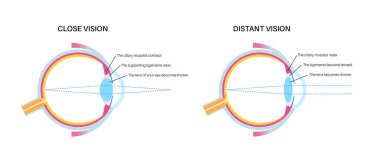Göz konaklama bilgileri. Retina ve sklera kasları kasılmış ve gevşemiş, yuvarlak ve düz lensler. Farklı uzaklıklardaki nesneler ve net görüntü vektör illüstrasyonunu koru